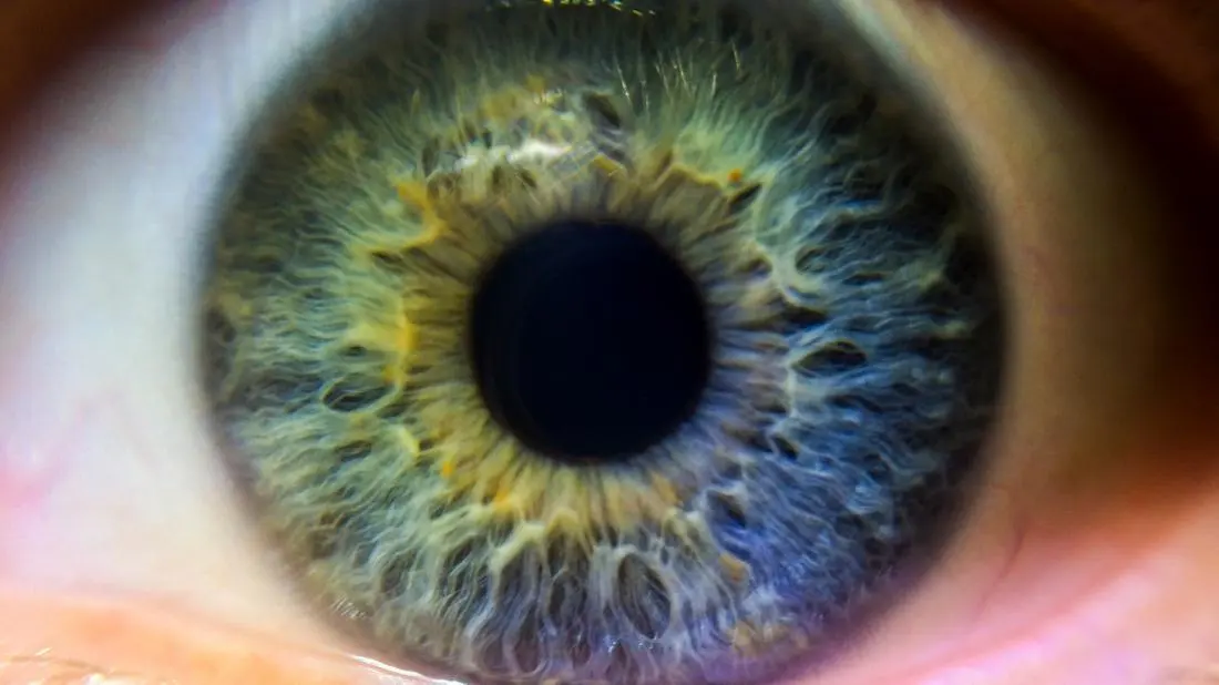 What determines eye color?