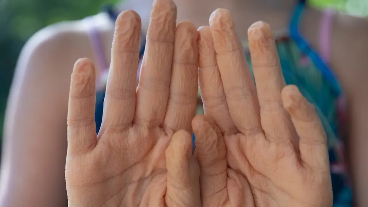 Why your fingers wrinkle in the bath