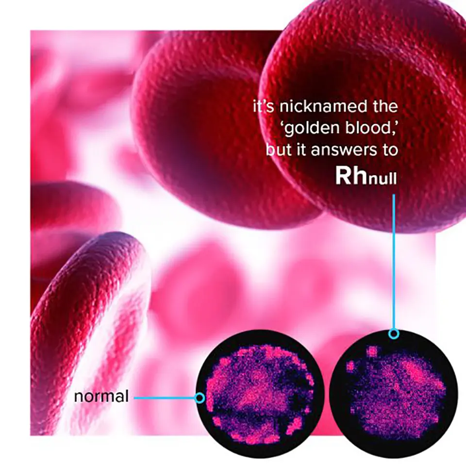 Rhnull is the World's Rarest Blood Type and Nicknamed "Golden Blood", Here's Why