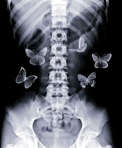 THE BUTTERFLIES IN MY STOMACH MIGHT BE DEAD